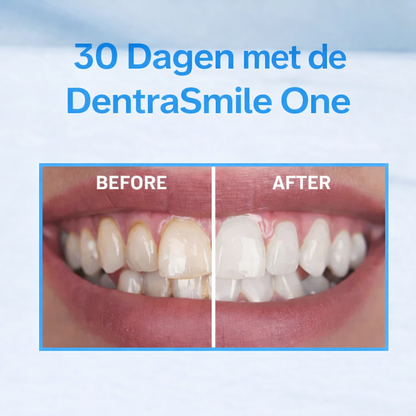 DentraSmile One